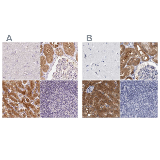 ALDH8A1 Antibody in Immunohistochemistry (IHC)