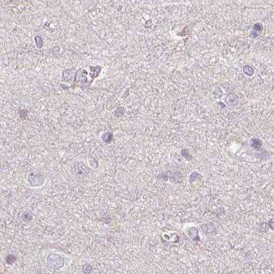 ALDH8A1 Antibody in Immunohistochemistry (IHC)