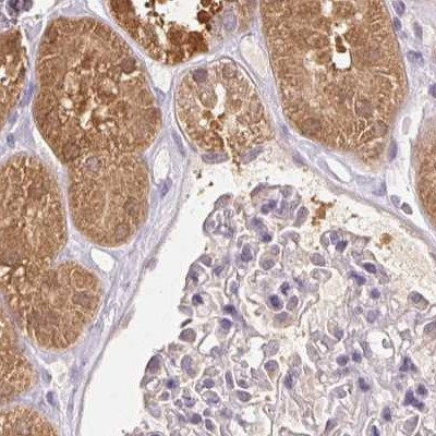 ALDH8A1 Antibody in Immunohistochemistry (IHC)