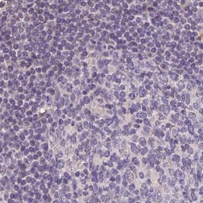 ALDH8A1 Antibody in Immunohistochemistry (IHC)