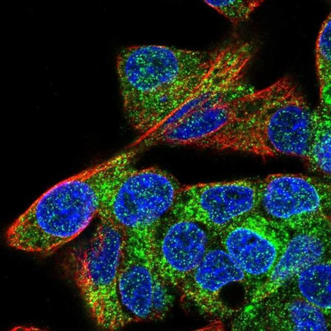 CTAGE5 Antibody in Immunocytochemistry (ICC/IF)