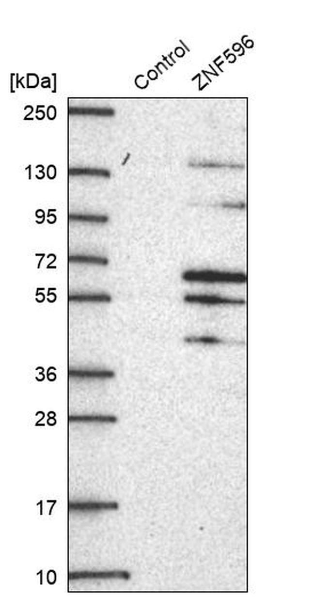 ZNF596 Antibody in Western Blot (WB)