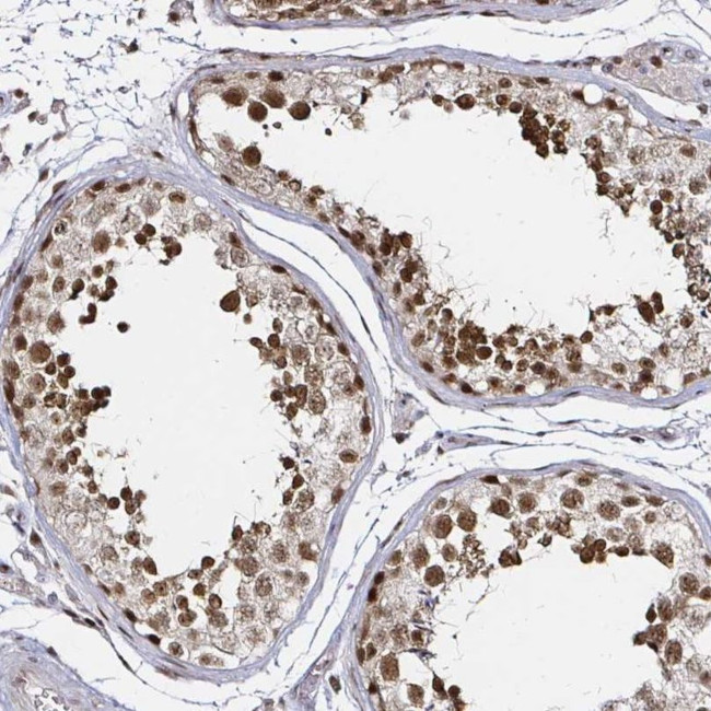 SNRPC Antibody in Immunohistochemistry (IHC)