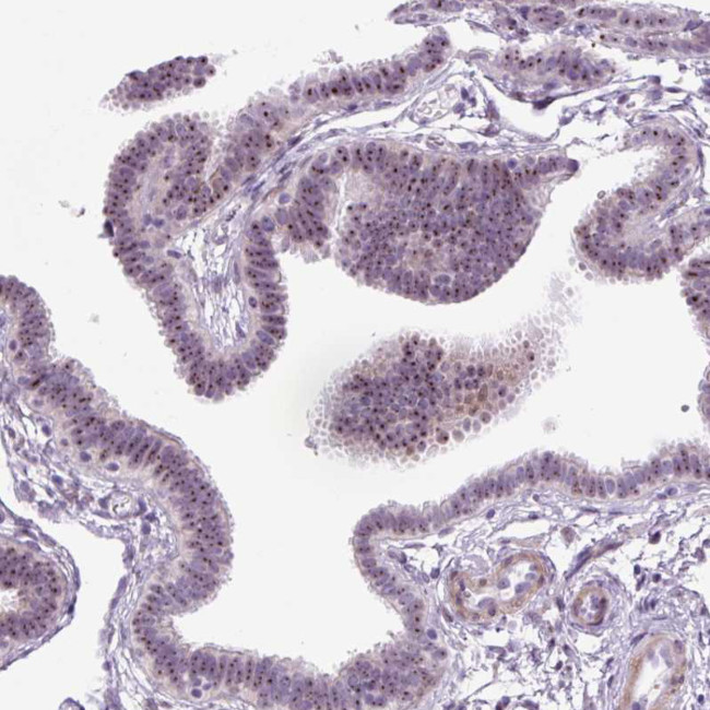 RRS1 Antibody in Immunohistochemistry (IHC)