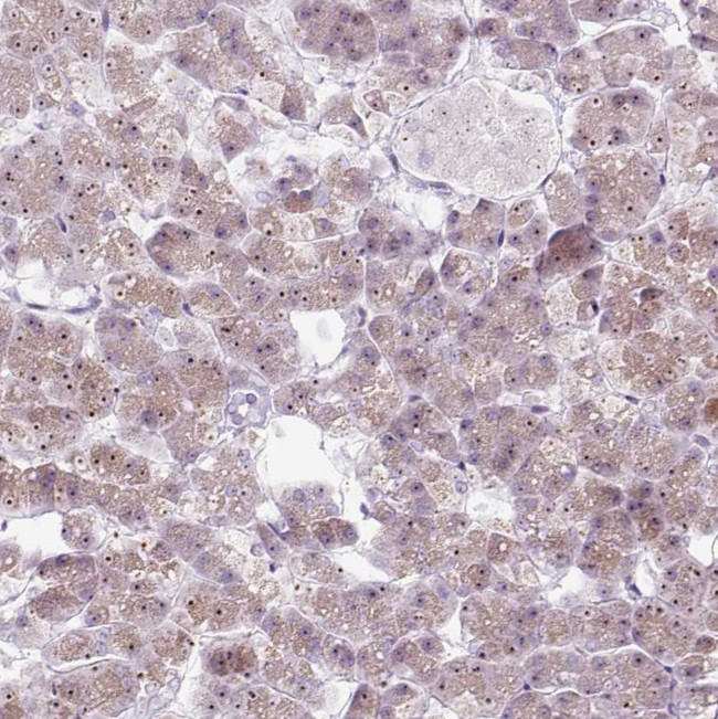 RRS1 Antibody in Immunohistochemistry (IHC)