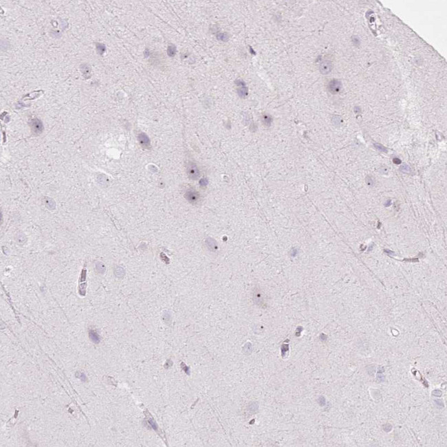 RRS1 Antibody in Immunohistochemistry (IHC)