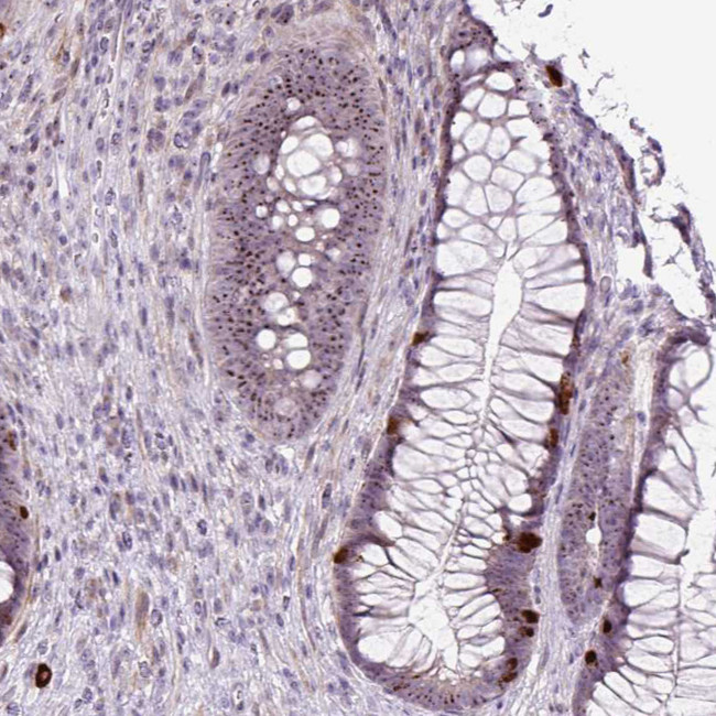 RRS1 Antibody in Immunohistochemistry (IHC)