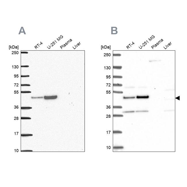 RRS1 Antibody in Western Blot (WB)