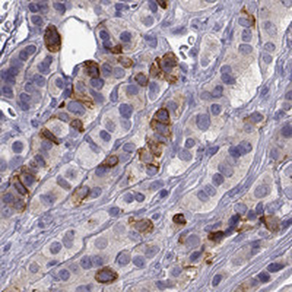 ZBTB8B Antibody in Immunohistochemistry (IHC)