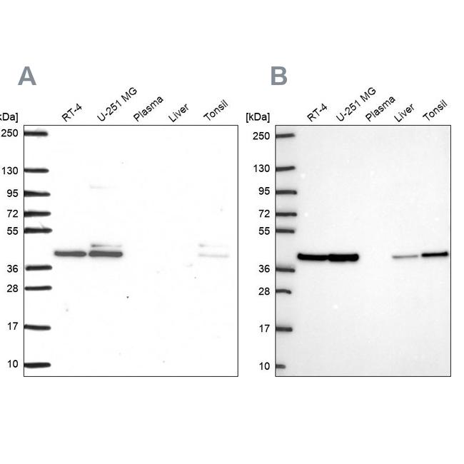 STRAP Antibody in Western Blot (WB)