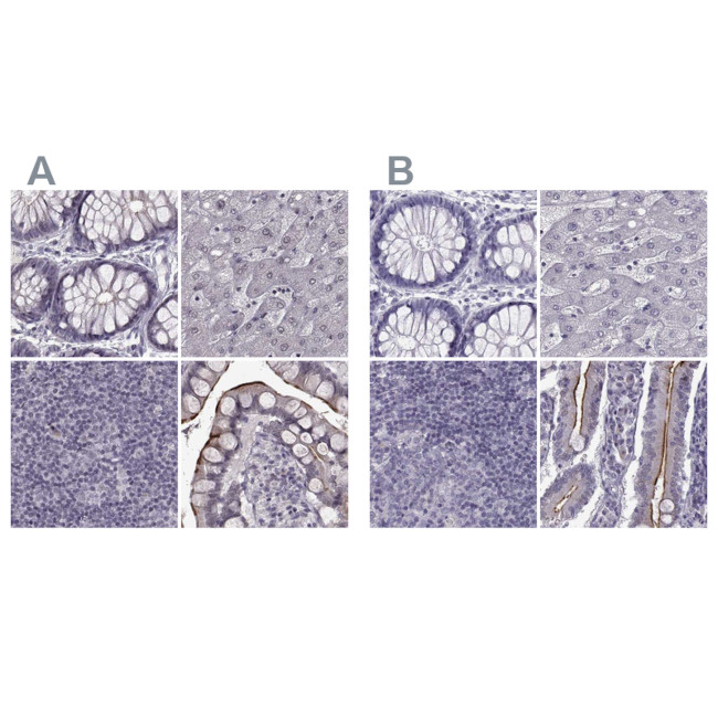 SLC28A2 Antibody in Immunohistochemistry (IHC)