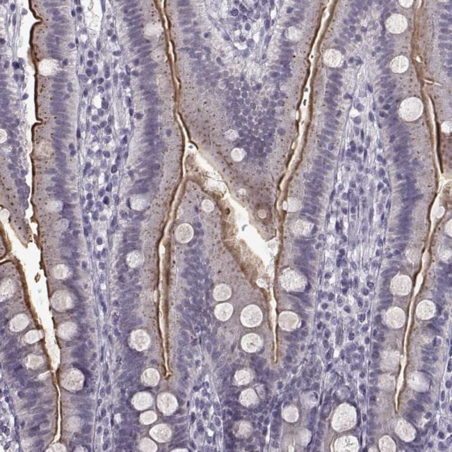 SLC28A2 Antibody in Immunohistochemistry (IHC)