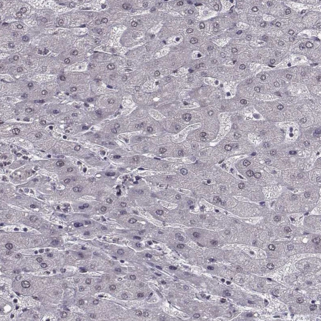 SLC28A2 Antibody in Immunohistochemistry (IHC)