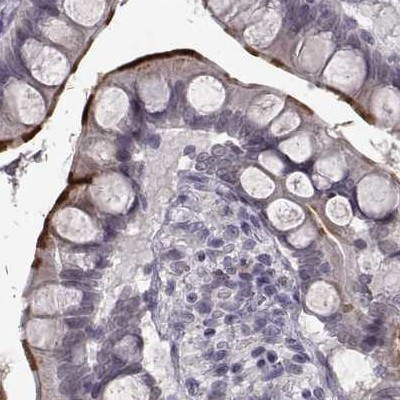 SLC28A2 Antibody in Immunohistochemistry (IHC)