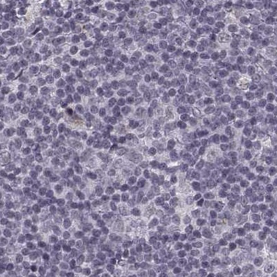 SLC28A2 Antibody in Immunohistochemistry (IHC)