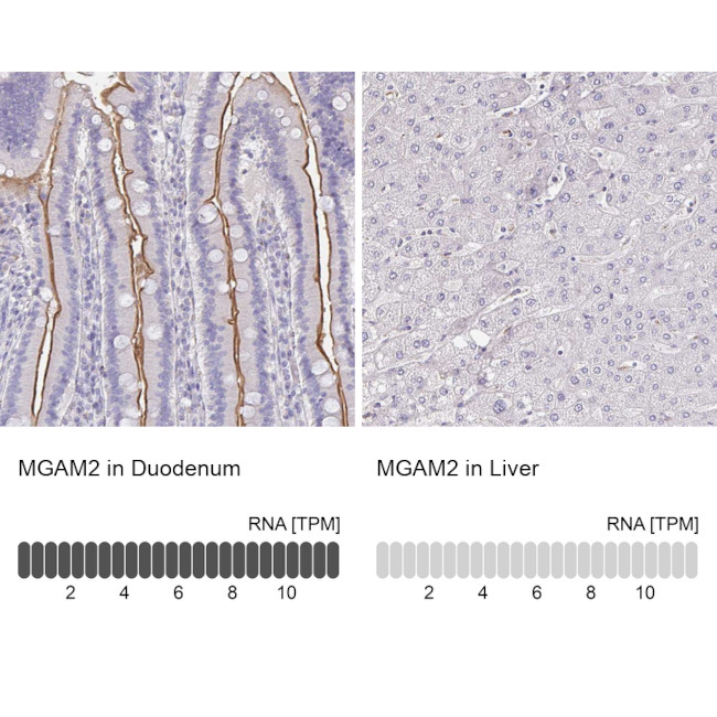 MGAM2 Antibody in Immunohistochemistry (IHC)