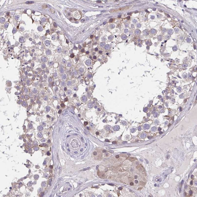 CHST3 Antibody in Immunohistochemistry (IHC)