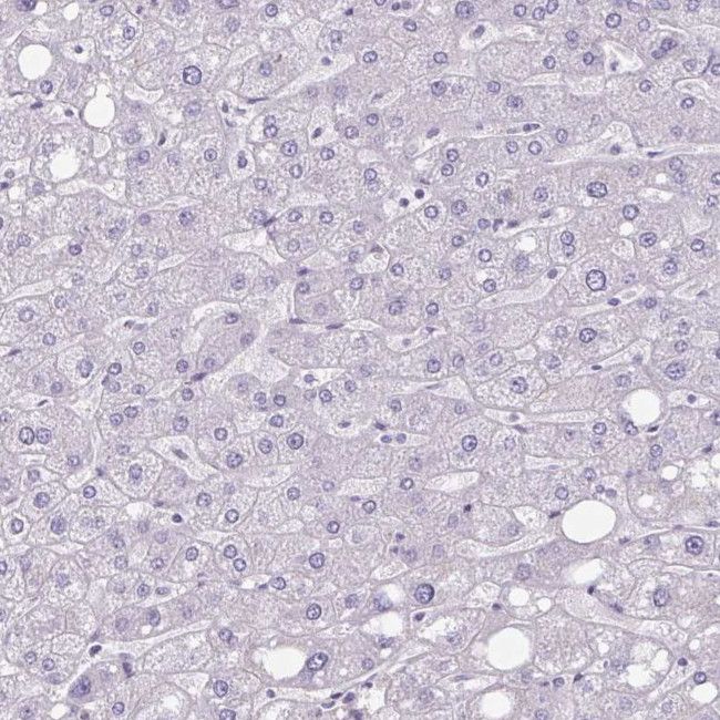 CHST3 Antibody in Immunohistochemistry (IHC)