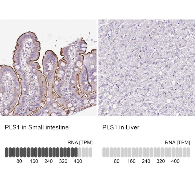 PLS1 Antibody in Immunohistochemistry (IHC)