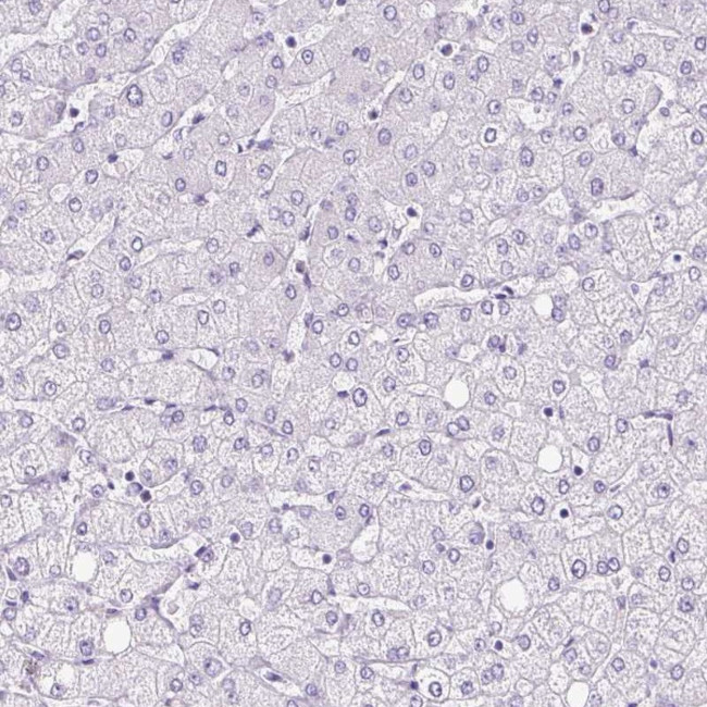 PLS1 Antibody in Immunohistochemistry (IHC)