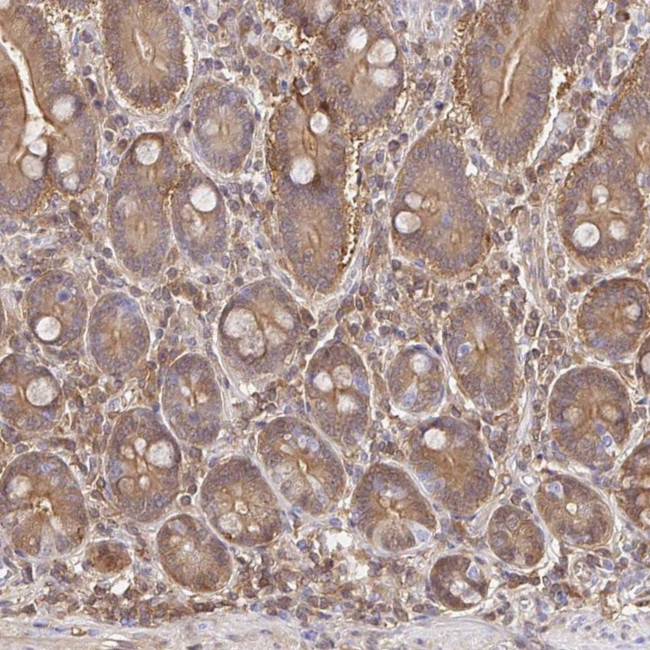 S100G Antibody in Immunohistochemistry (IHC)