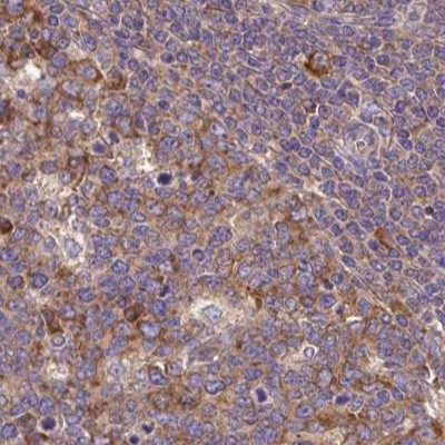 RPS5 Antibody in Immunohistochemistry (IHC)