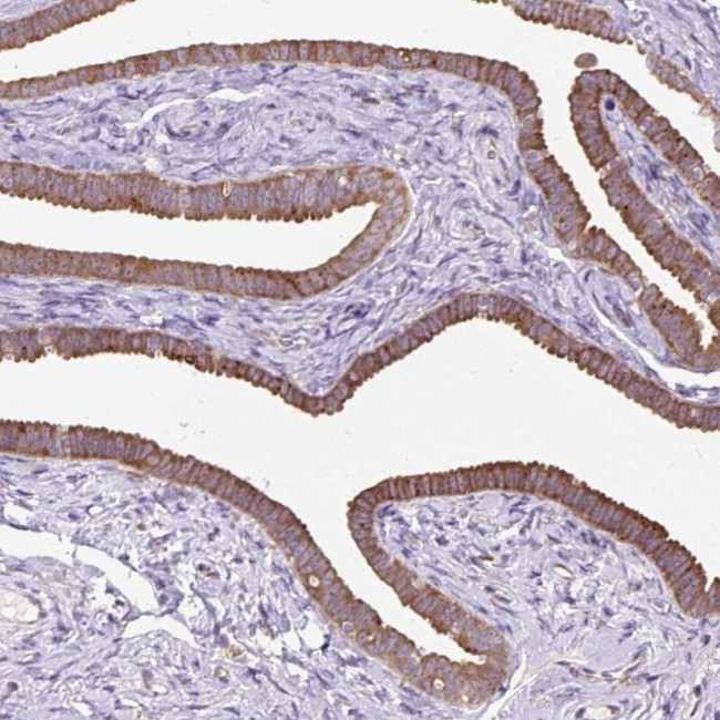 RPS5 Antibody in Immunohistochemistry (IHC)