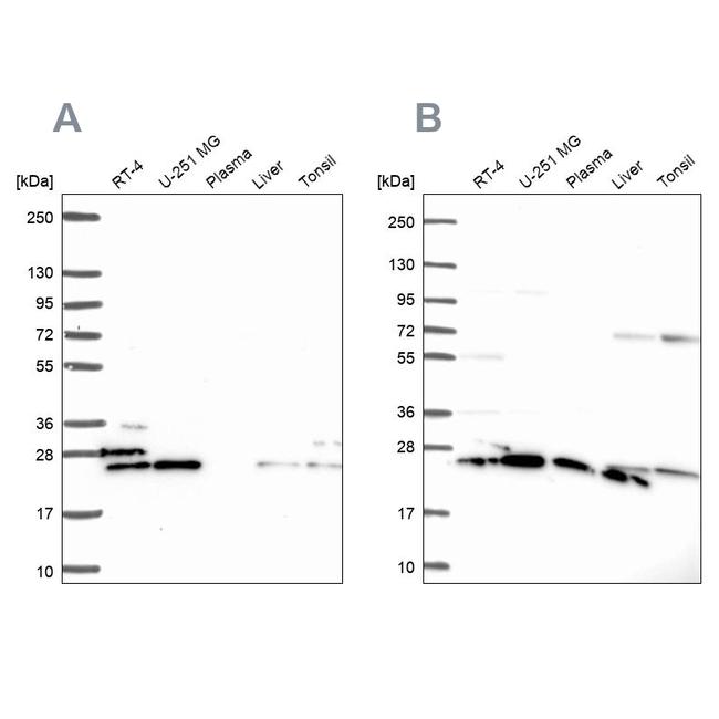 RPS5 Antibody in Western Blot (WB)