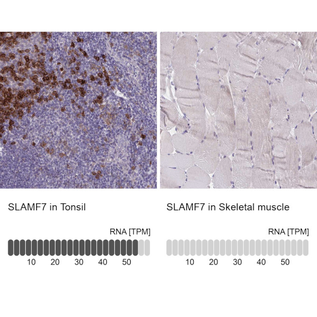 CRACC Antibody in Immunohistochemistry (IHC)