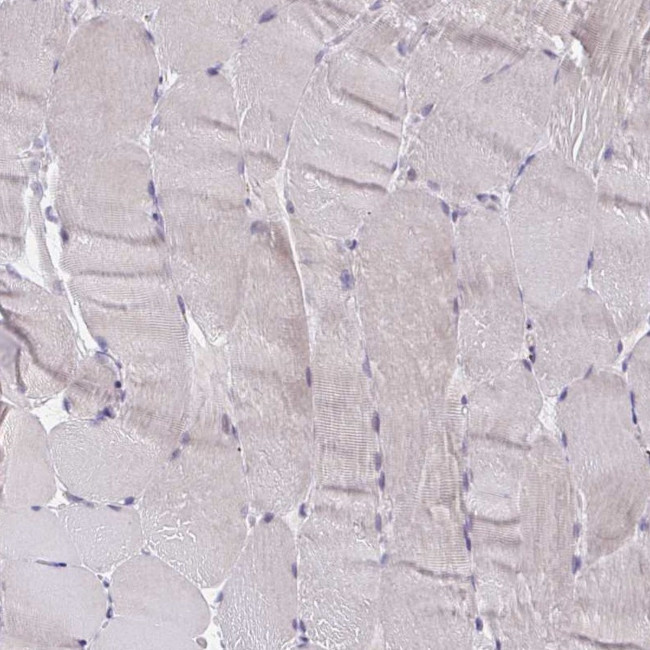 CRACC Antibody in Immunohistochemistry (IHC)