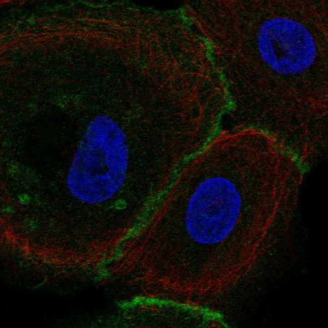 FLRT3 Antibody in Immunocytochemistry (ICC/IF)