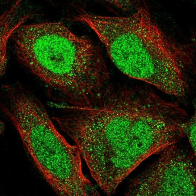 JMJD1C Antibody in Immunocytochemistry (ICC/IF)