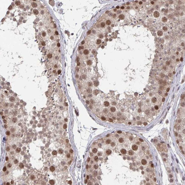 JMJD1C Antibody in Immunohistochemistry (IHC)