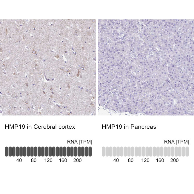 NSG2 Antibody in Immunohistochemistry (IHC)