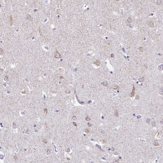 NSG2 Antibody in Immunohistochemistry (IHC)