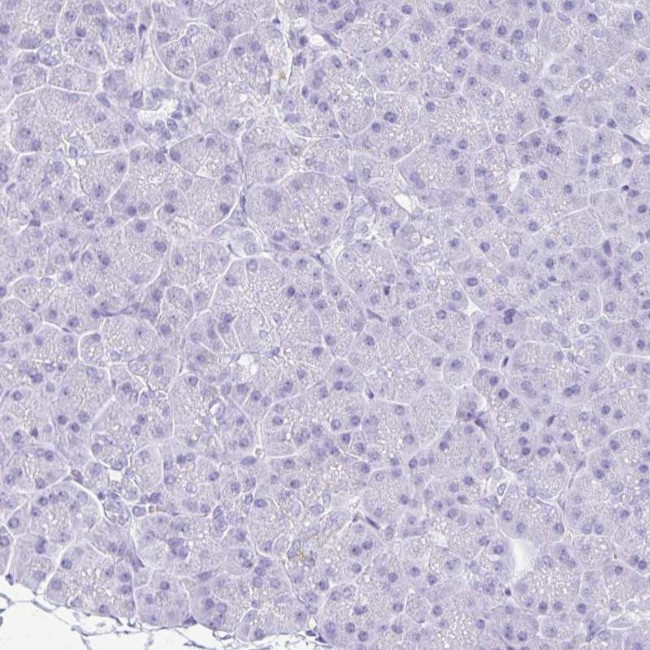 NSG2 Antibody in Immunohistochemistry (IHC)