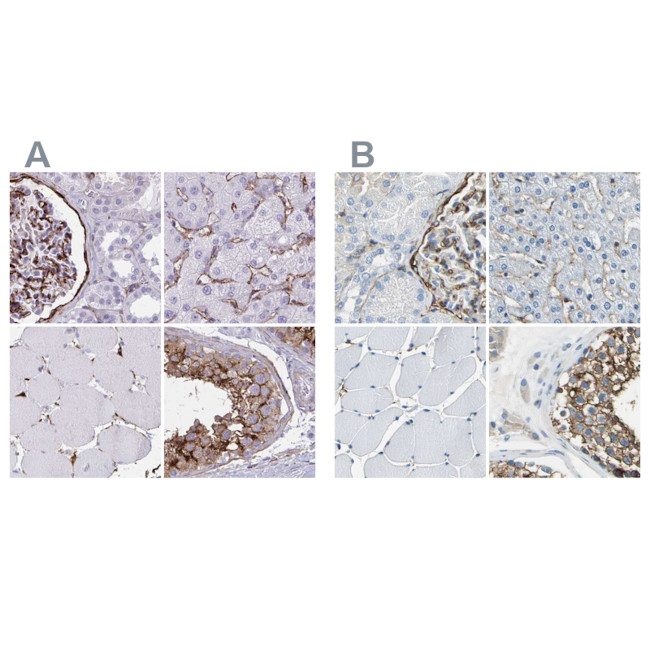 AKAP12 Antibody in Immunohistochemistry (IHC)