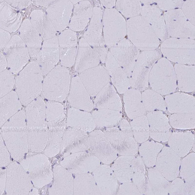 AKAP12 Antibody in Immunohistochemistry (IHC)