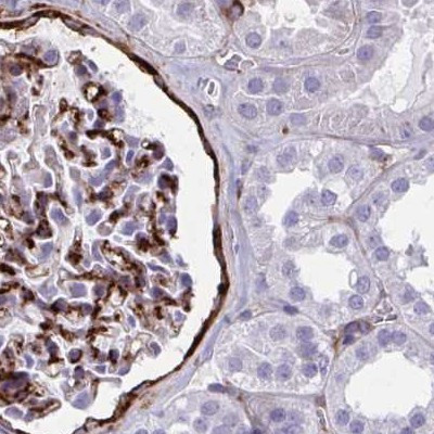 AKAP12 Antibody in Immunohistochemistry (IHC)