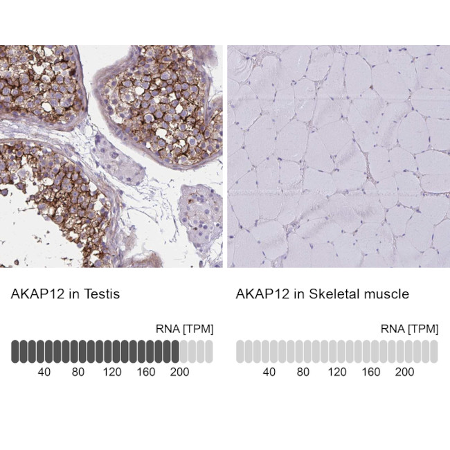 AKAP12 Antibody