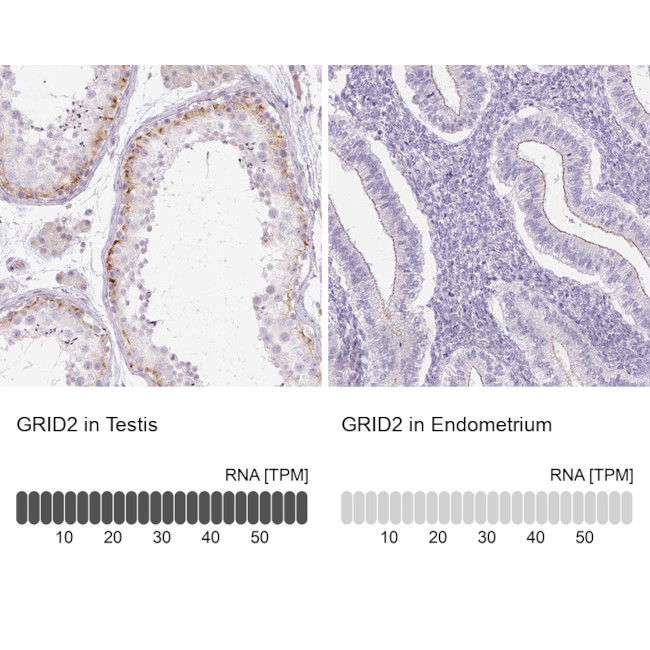 GRID2 Antibody in Immunohistochemistry (IHC)