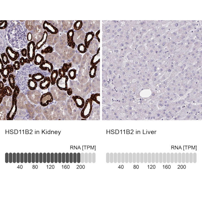 HSD11B2 Antibody in Immunohistochemistry (IHC)