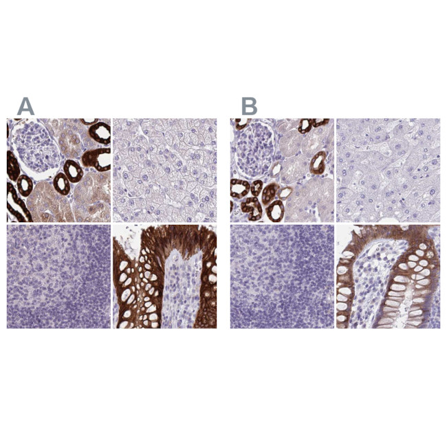 HSD11B2 Antibody in Immunohistochemistry (IHC)