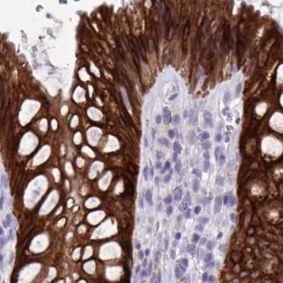 HSD11B2 Antibody in Immunohistochemistry (IHC)