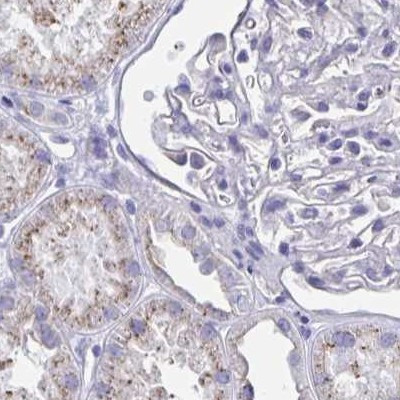 CHMP5 Antibody in Immunohistochemistry (IHC)