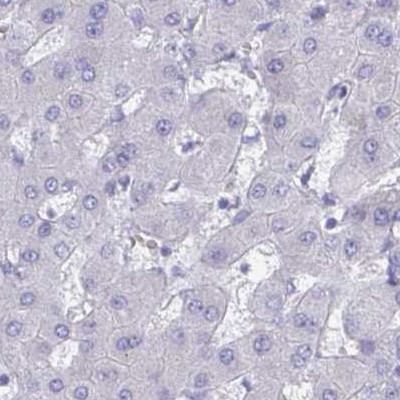 CHMP5 Antibody in Immunohistochemistry (IHC)