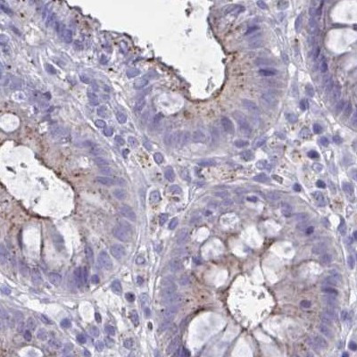 CHMP5 Antibody in Immunohistochemistry (IHC)