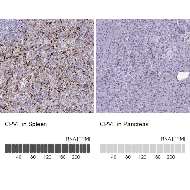 CPVL Antibody