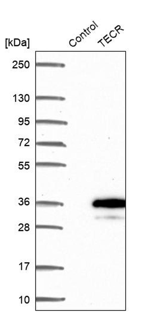 GPSN2 Antibody in Western Blot (WB)