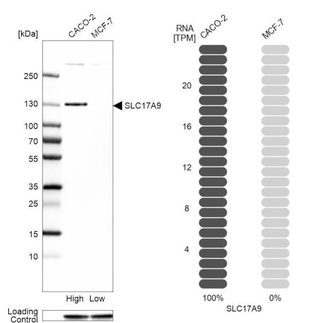 SLC17A9 Antibody